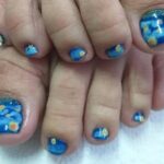 pies uñas
